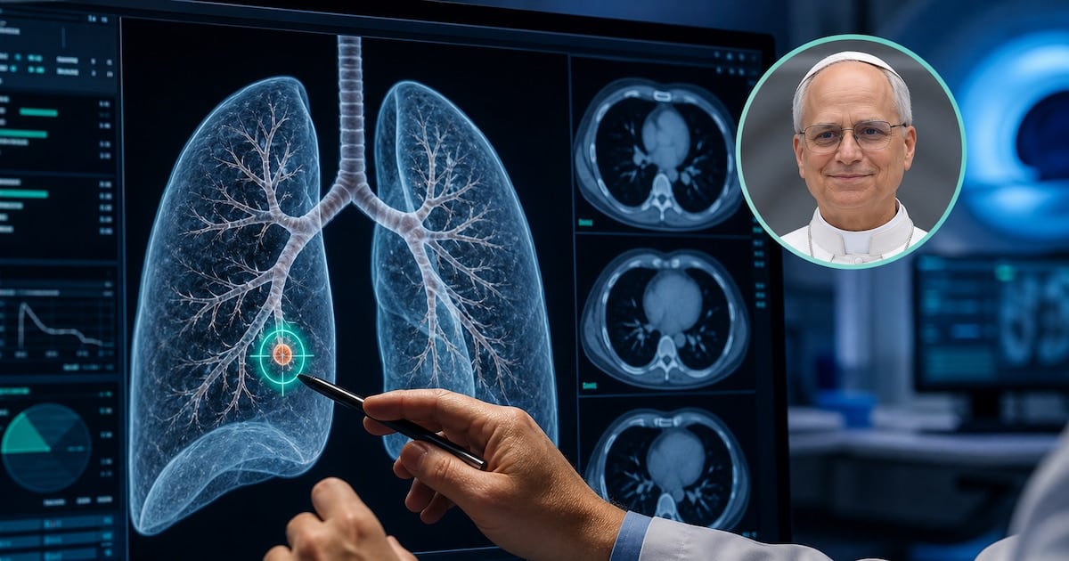 Tres milímetros, una decisión grande: cuando un nódulo pulmonar se opera antes de que el cuerpo lo cuente